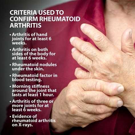 diz artriti için testler